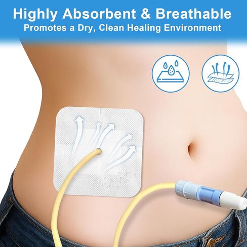 20 حزمة من الضمادات اللاصقة المقسمة لقسطرة PD وأنابيب التغذية، وملحقات غسيل الكلى على شكل جزيرة مقاس 4 × 4 بوصة مع حدود لتأمين أنبوب G وأنبوب J ومواقع الصرف، مغلفة بشكل فردي in Kuwait