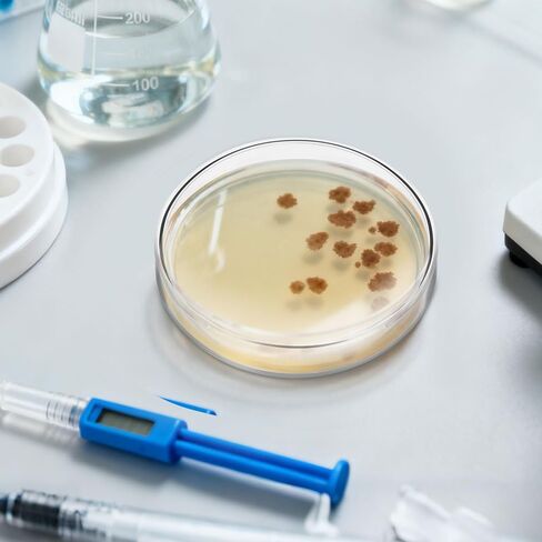 10 عبوات من أطباق أجار المغذيات المصبوبة مسبقًا من DOITOOL مقاس 2.75 بوصة مع طبقة أجار سميكة للتجارب العلمية ومستلزمات المختبرات للطلاب in Kuwait