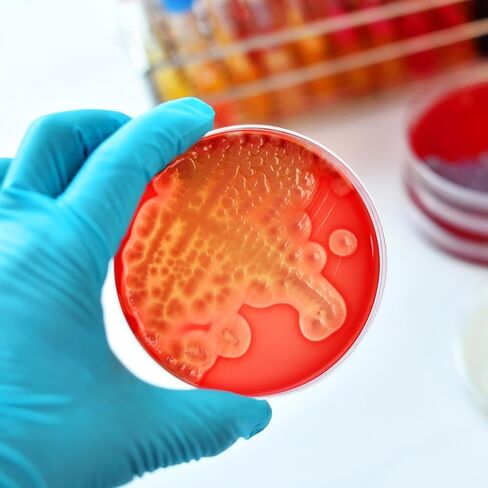 20 قطعة من أطباق أجار مسبقة الصنع من DOITOOL لتجارب العلوم المخبرية ومشاريع المعارض المدرسية in Kuwait