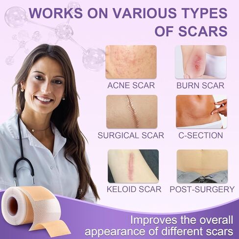 Silicone Scar Sheets, Advanced Medical Silicone Scar Tape(1.6"x 60"Roll-1.5M), Professional Grade Scar Removal Strip for Surgery, Tummy, Mouth, Face, C Section, Burn, Keloid, Acne Scars etc in Saudi Arabia