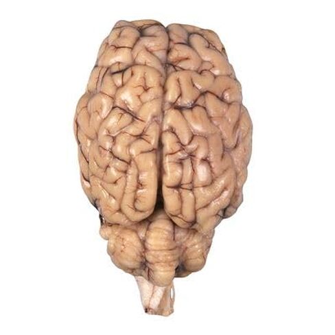 Formalin Sheep Brain, Dura Mater Removed, Plain, 1 Per Bag in Kuwait