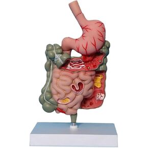 Human Stomach Anatomy Model Pathological Digestive System Model, Removerable Teaching Model,Stomach Section Large Small Intestine Medical Model Anatomy in Kuwait