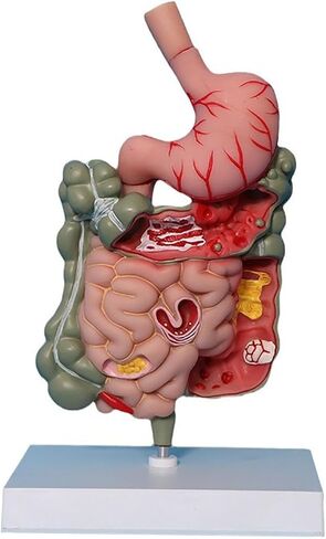 Human Stomach Anatomy Model Pathological Digestive System Model, Removerable Teaching Model,Stomach Section Large Small Intestine Medical Model Anatomy in Kuwait