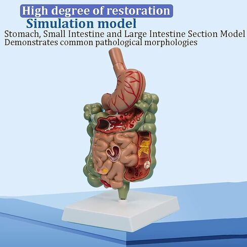 Human Stomach Anatomy Model Pathological Digestive System Model, Removerable Teaching Model,Stomach Section Large Small Intestine Medical Model Anatomy in Kuwait