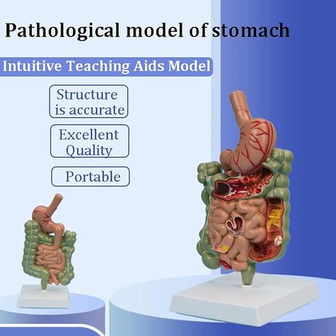 Human Stomach Anatomy Model Pathological Digestive System Model, Removerable Teaching Model,Stomach Section Large Small Intestine Medical Model Anatomy in Kuwait