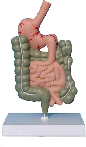 Human Stomach Anatomy Model Pathological Digestive System Model, Removerable Teaching Model,Stomach Section Large Small Intestine Medical Model Anatomy in Kuwait