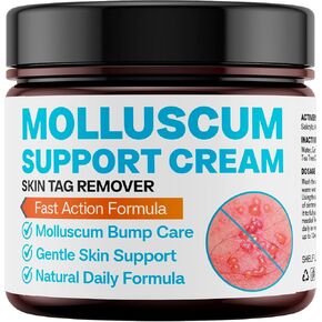 Molluscum Support Treatment, Molluscum Support Cream All Natural Support Cream for Molluscum Rash, SALICYLIC Acid 10% in Kuwait