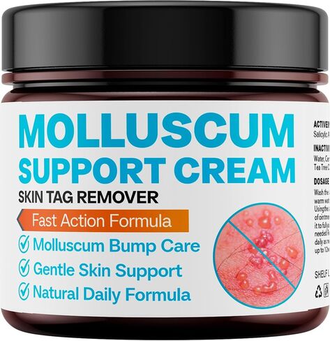 Molluscum Support Treatment, Molluscum Support Cream All Natural Support Cream for Molluscum Rash, SALICYLIC Acid 10% in Kuwait