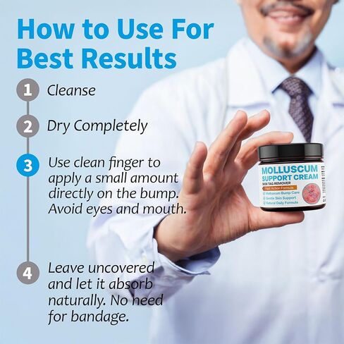 Molluscum Support Treatment, Molluscum Support Cream All Natural Support Cream for Molluscum Rash, SALICYLIC Acid 10% in Kuwait