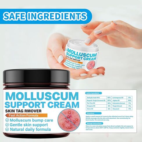 Molluscum Support Treatment, Molluscum Support Cream All Natural Support Cream for Molluscum Rash, SALICYLIC Acid 10% in Kuwait