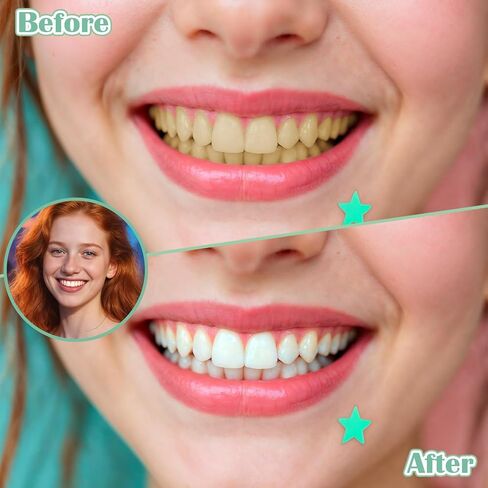 100 Pcs Interdental Brushes Braces Brush for Cleaner Dental Cleaning Tools Soft Tooth Floss Picks for Braces Bridges Care, Portable Bendable Heads in Kuwait