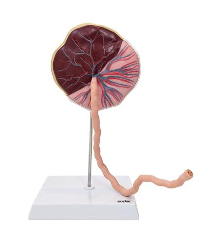 Axis Scientific Placenta Model with Removable Umbilical Cord Anatomical Model - Birthing Anatomy Model, Placenta Umbilical Cord Anatomical Model, Education for Medical School in Saudi Arabia
