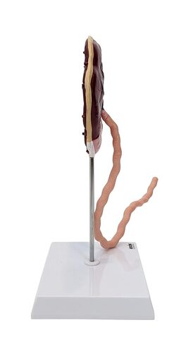 Axis Scientific Placenta Model with Removable Umbilical Cord Anatomical Model - Birthing Anatomy Model, Placenta Umbilical Cord Anatomical Model, Education for Medical School in Saudi Arabia