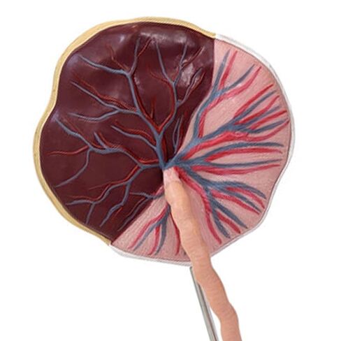 Axis Scientific Placenta Model with Removable Umbilical Cord Anatomical Model - Birthing Anatomy Model, Placenta Umbilical Cord Anatomical Model, Education for Medical School in Saudi Arabia