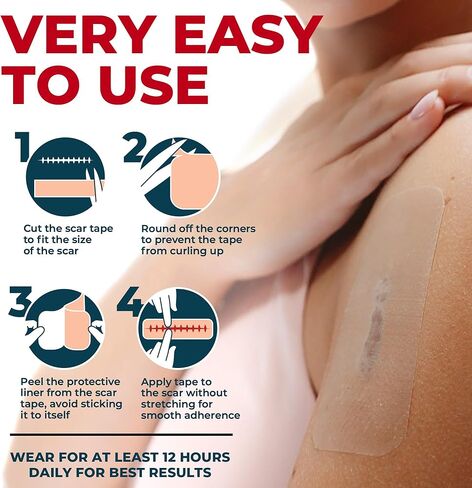 شريط ندبات من السيليكون الطبي - 1.6 بوصة × 70 بوصة - إزالة فعالة للندبات الجراحية، والجُدرات، والقسم القيصري، وشد البطن، والندبات الضخامية وحب الشباب - علاج سهل الاستخدام - أوراق ندبات السيليكون القابلة لإعادة الاستخدام in Kuwait