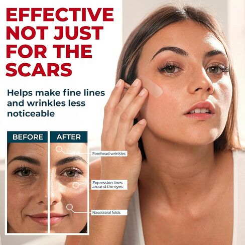 شريط ندبات من السيليكون الطبي - 1.6 بوصة × 70 بوصة - إزالة فعالة للندبات الجراحية، والجُدرات، والقسم القيصري، وشد البطن، والندبات الضخامية وحب الشباب - علاج سهل الاستخدام - أوراق ندبات السيليكون القابلة لإعادة الاستخدام in Kuwait