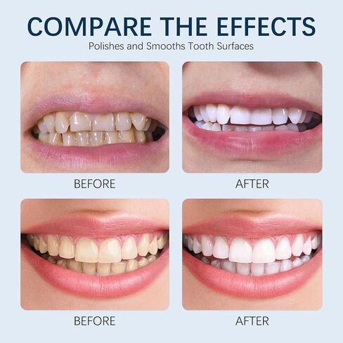 2PCS Tooth Paint,Tooth Polish White,Instant Teeth Whitening,Portable Gentle Teeth Whitening Kit,Safe Formula & Long-Lasting,10ml in Kuwait