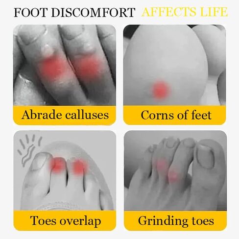 Breathable Silicone Little Toe Sleeves (for Women) with Airflow Holes，Gel Toe Covers，Silicone Anti-Friction Toe Protector，Breathable Gel Toe Separators (30) in Saudi Arabia