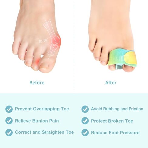 مصحح إصبع القدم من نيوبيور مع شريط، فاصل إصبع القدم من السيليكون مكون من 4 قطع للنساء والرجال، فاصل إصبع القدم المطرقة للتداخل، لفافة إصبع القدم المكسورة/جبيرة لتقليل آلام احتكاك القدم in Kuwait