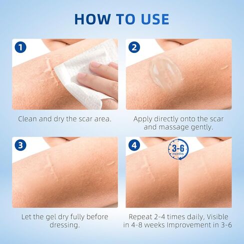 Silicone Scar Gel for Old and New Scars, Stretch Marks & Acne Scar Removal, Advanced Silicone Scar Cream for Surgical, Burn, Keloid, Injury & Acne Scars, Fast Absorbing Gel, 1.76 oz (50ml) in Saudi Arabia