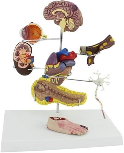 Human Medical Diabetes Complication Organ Model Brain Heart Pancreas Neuron Foot Model in Saudi Arabia