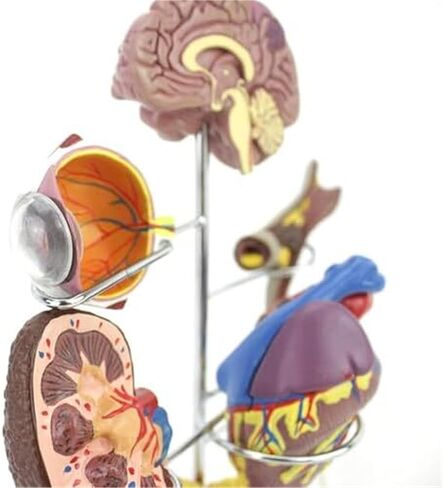 Human Medical Diabetes Complication Organ Model Brain Heart Pancreas Neuron Foot Model in Saudi Arabia