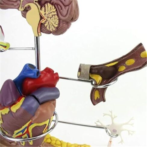 Human Medical Diabetes Complication Organ Model Brain Heart Pancreas Neuron Foot Model in Saudi Arabia