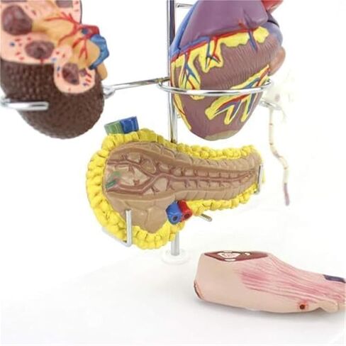 Human Medical Diabetes Complication Organ Model Brain Heart Pancreas Neuron Foot Model in Saudi Arabia