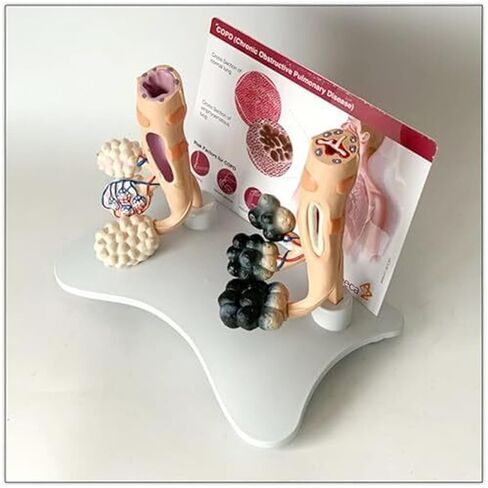 Human Alveolar Model, Comparative Model of Health and Pathology, and Enlarged Structure for Learning Display Teaching in Saudi Arabia