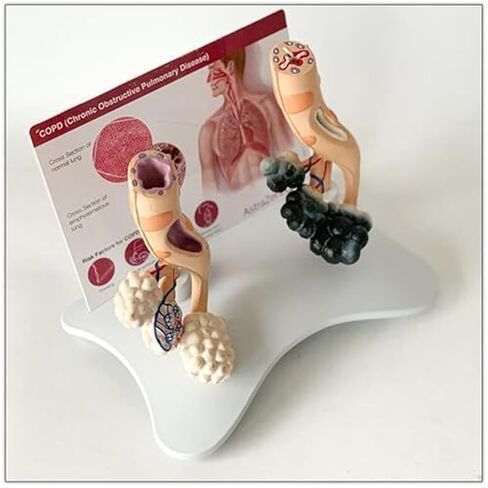 Human Alveolar Model, Comparative Model of Health and Pathology, and Enlarged Structure for Learning Display Teaching in Saudi Arabia