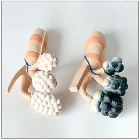 Human Alveolar Model, Comparative Model of Health and Pathology, and Enlarged Structure for Learning Display Teaching in Saudi Arabia