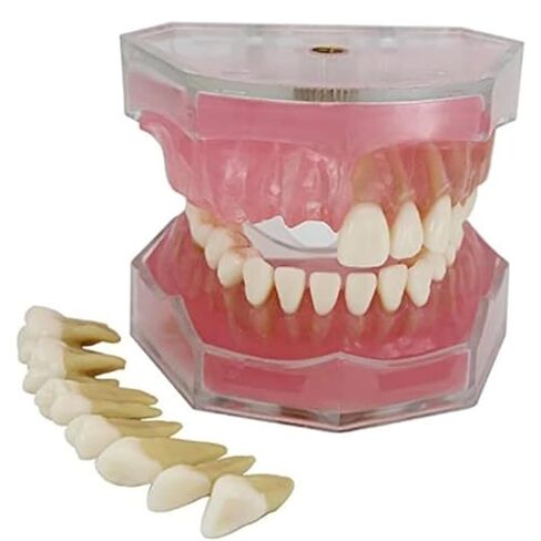 Detachable Tooth Model Standard Full Mouth Soft Rubber Adult Teaching Model in Saudi Arabia