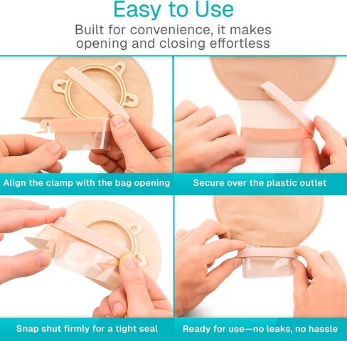 Vive 10 PCS Ostomy Bag Clips - Universal Drainable Pouch Sealing Clamps - Medical Grade Ostomy Supplies for Colostomy, Ileostomy, Postoperative Care (10) in Kuwait