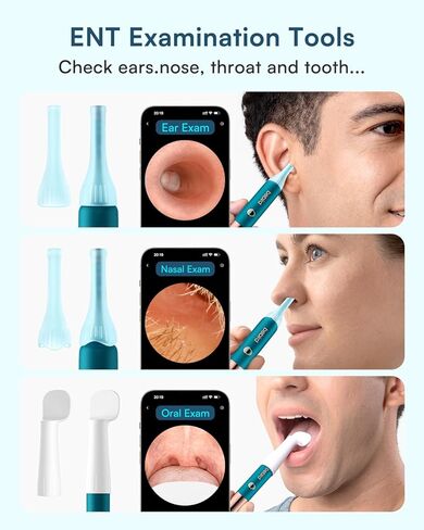Bebird Earsight Ultra Ear Wax Removal Tool Camera, FSA HSA Eligible Ear Cleaner with 2K HD Camera Otoscope, 90-minute Battery Earwax Remover &Visual Ear Pick Tweezers, Safe Ear Cleaning Kit for Family in Kuwait