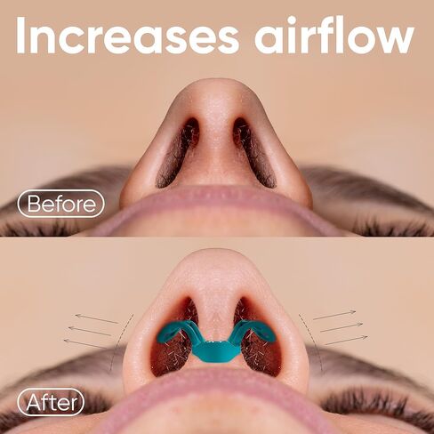 Brison Nasal Dilators for Breathing and Sleeping - 3 Pack Anti Snoring Nose Vents Opener for Better Breathing Sleep ing and Activity Improves Airflow - Soft in Kuwait