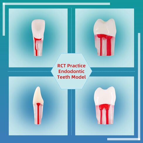 Teeth Model，32Pcs Dental Root Canal Pulp Cavity Teeth Model Dental Root Canal Pulp Cavity Practice Endodontic Pulp-Opened RCT Teeth Model for Dental Students,Root Canal，Endodontic Teeth in Kuwait