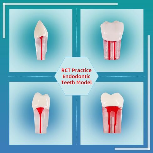 Teeth Model，32Pcs Dental Root Canal Pulp Cavity Teeth Model Dental Root Canal Pulp Cavity Practice Endodontic Pulp-Opened RCT Teeth Model for Dental Students,Root Canal，Endodontic Teeth in Kuwait