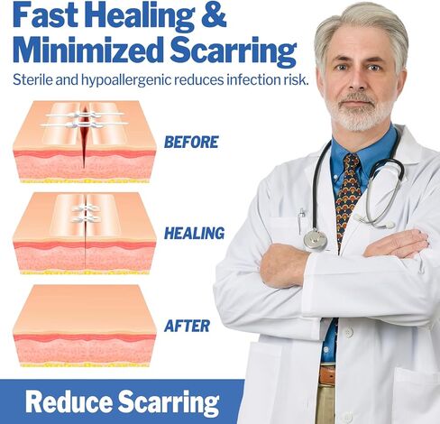 AZEN 16 حزمة شرائط إغلاق الجروح، 4 أنواع من ضمادات الفراشة، مجموعة إغلاق التمزق في حالات الطوارئ، إصلاح الجروح بدون غرز، جهاز إغلاق الجروح بسحاب سريع in Kuwait