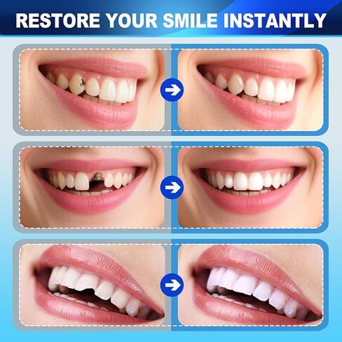 طقم أسنان مؤقت DIY مع خرزات حرارية قابلة للتشكيل، غطاء فجوة الأسنان التجميلية للأسنان المفقودة أو المكسورة in Kuwait