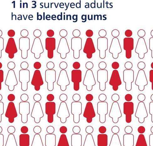 Parodontax Toothpaste for Bleeding Gums, Gingivitis Treatment and Cavity Prevention, Clean mint - 3.4 Ounces in Kuwait