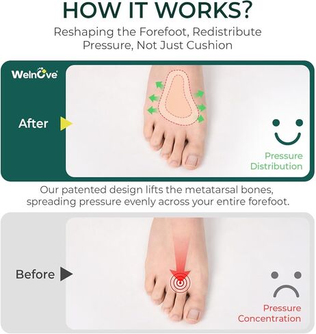 Welnove Metatarsal Pads for Women Men - T-Shape - 4 Pairs Leather Ball-of-Foot Honeycomb Cushions - Soft Ball of Foot Pads for Metatarsalgia, Morton’s Neuroma, Fit for High Heels, Shoes - Gray in Saudi Arabia