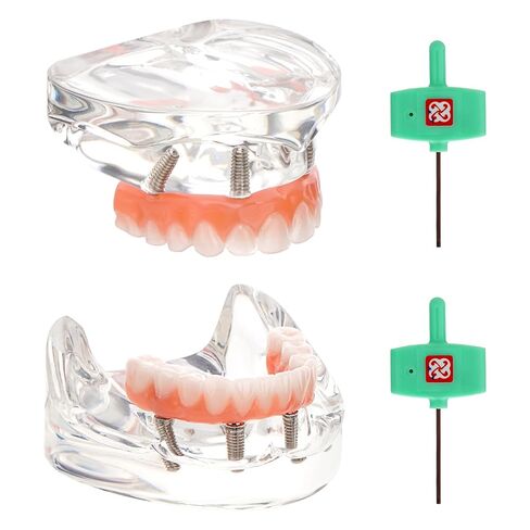 PER4MANCE All-on-4 Dental Implant Model: Includes Upper and Lower Jaw with Transparent Base, Removable Crowns for Educational Demonstration in Kuwait