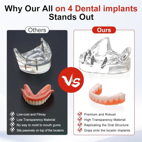 PER4MANCE All-on-4 Dental Implant Model: Includes Upper and Lower Jaw with Transparent Base, Removable Crowns for Educational Demonstration in Kuwait
