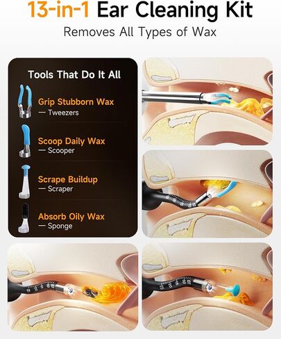 Flexible Ear Wax Removal Tool Camera, Wireless Ear Cleaner with 10MP HD Otoscope, Painless Tweezers, 12 Soft Tips, 3 Inspection Heads, Portable Earwax Removal Kit with Camera for Adults/Kids in Saudi Arabia