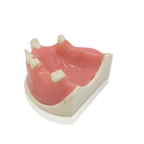 Human Skeletal Anatomy Dental Model for Studying Oral Patient Education in Saudi Arabia