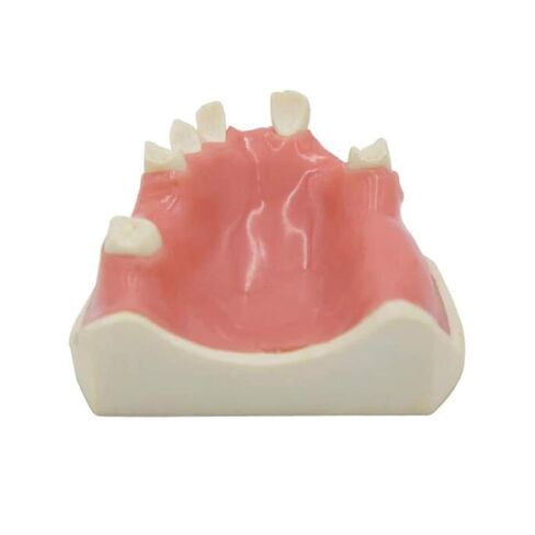 Human Skeletal Anatomy Dental Model for Studying Oral Patient Education in Saudi Arabia