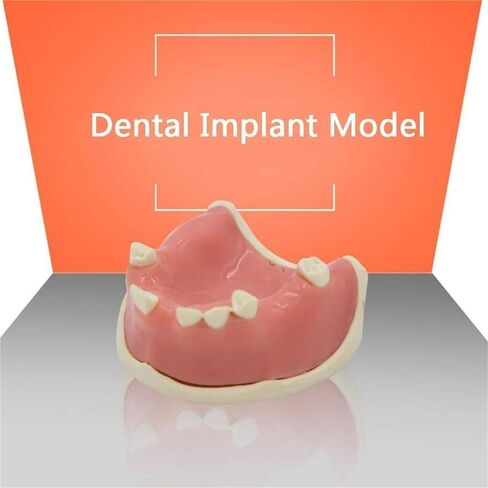 Human Skeletal Anatomy Dental Model for Studying Oral Patient Education in Saudi Arabia