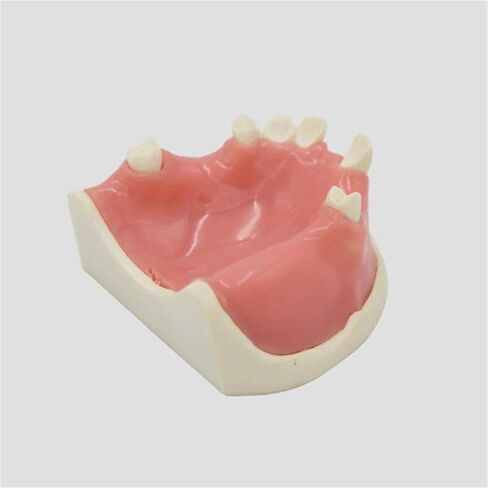 Human Skeletal Anatomy Dental Model for Studying Oral Patient Education in Saudi Arabia