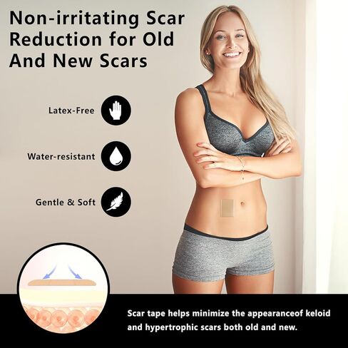 صفائح الندبات من السيليكون، شريط الندبات من السيليكون، شريط الندبات مقاس 1.6 × 60 بوصة، شريط السيليكون للندبات، أوراق الندبات من السيليكون للندبات الجراحية، للقسم القيصري، شد البطن، ندبات حب الشباب، إزالة ندبات الجدرة in Kuwait