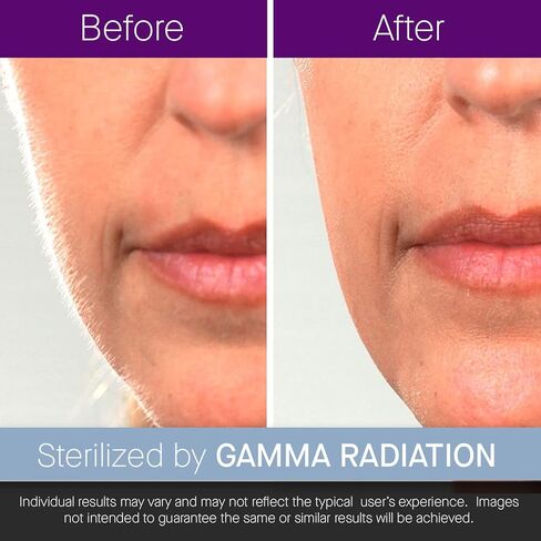 Pack of 4 Scalpel Handles #3 + 300 Scalpel Blades #11 Set in Kuwait